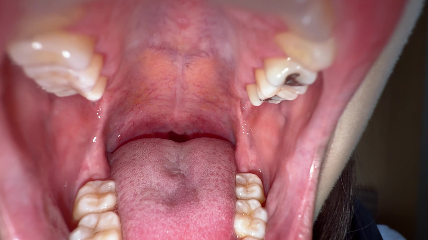 「【湊波流】舌ブラシで舌苔採取する個人撮影フェチ動画｜唾液・口腔マニア必見」のサンプル画像7枚目