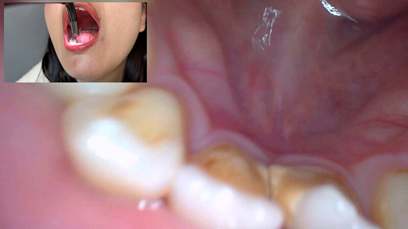 「【素人ナンパ】コールセンター勤務の美人お姉さんに街角で声かけ！口内観察に恥じらう姿が可愛すぎる」のサンプル画像14枚目