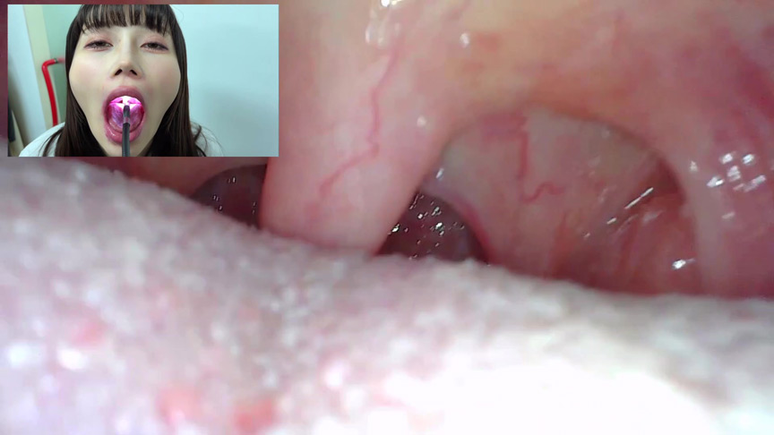「【口腔観察】歯・舌・喉をじっくり接写！素人4名の口内フェチ動画55分セット」のサンプル画像2枚目