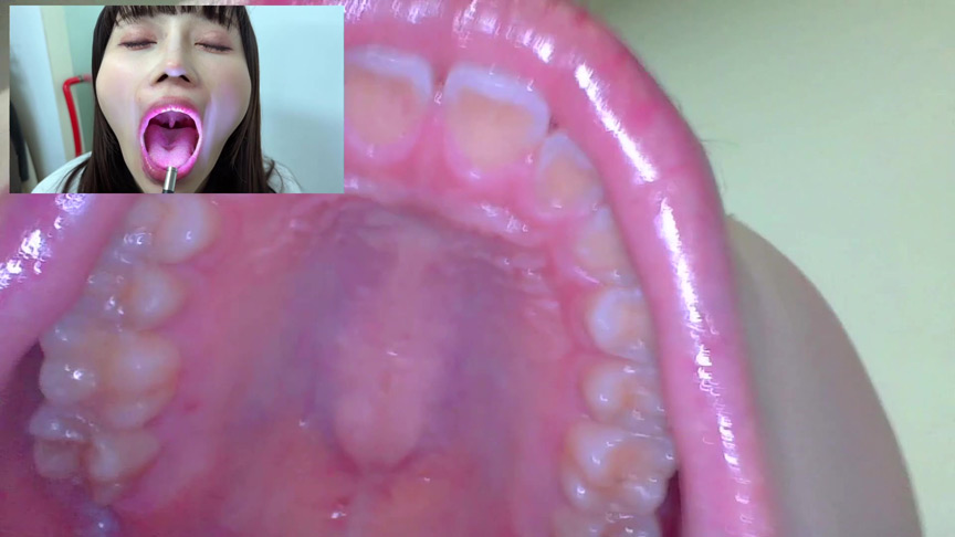 「【口腔観察】歯・舌・喉をじっくり接写！素人4名の口内フェチ動画55分セット」のサンプル画像4枚目