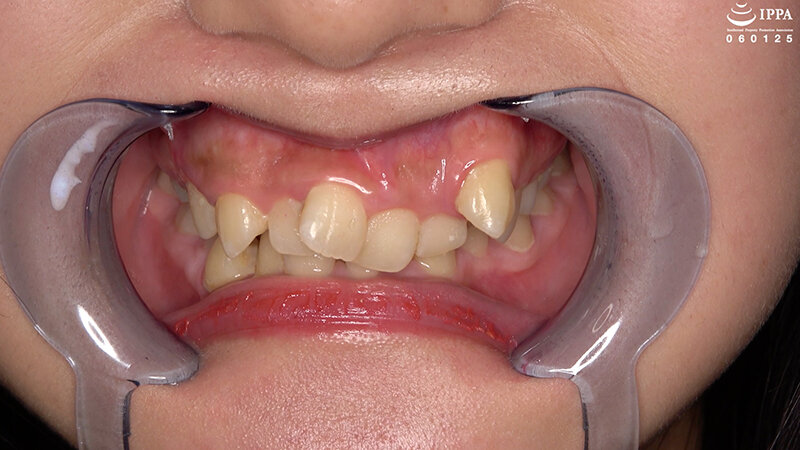 「【相楽さゆな】美少女M女の口内観察＆巨大女フェチプレイ｜歯・口腔フェチ動画」のサンプル画像2枚目