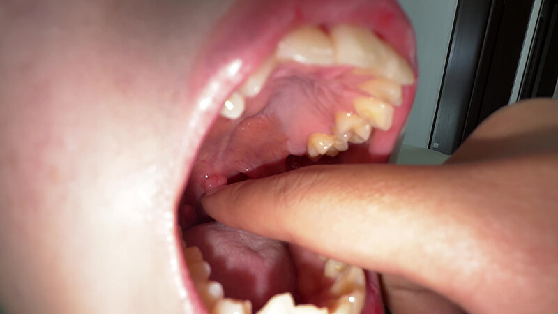 「【水月みお】素人お姉さんをナンパ！初めての喉奥体験と舌・八重歯観察の個人撮影動画」のサンプル画像9枚目