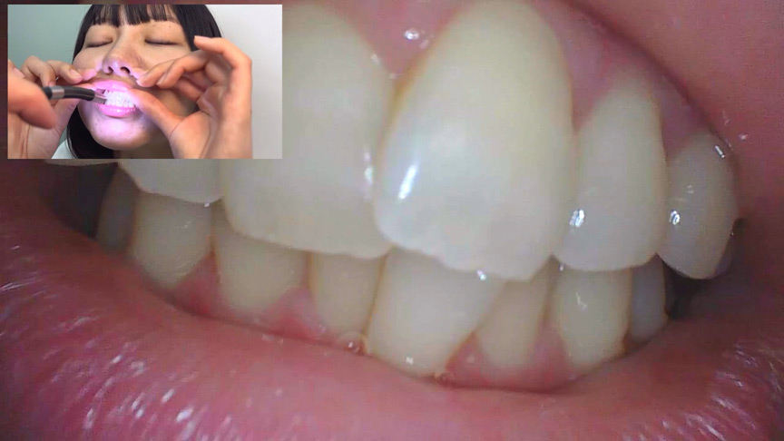 「【素人AD】みゆりちゃんの口内観察プレイ｜街角ナンパ企画で歯・舌・喉をじっくり撮影【フェチ動画】」のサンプル画像16枚目