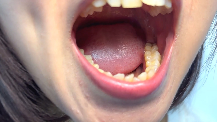 「【素人AD】みゆりちゃんの口内観察プレイ｜街角ナンパ企画で歯・舌・喉をじっくり撮影【フェチ動画】」のサンプル画像5枚目